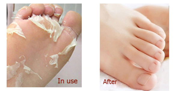 Foot Exfoliating Cream 4